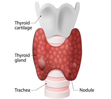 Head and neck surgeon evaluating thyroid nodules