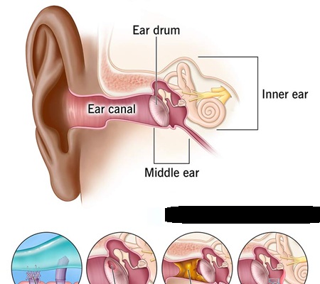 Audiology and hearing screening for tinnitus management